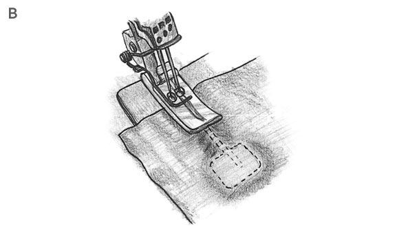 Piedino per nervature e guida